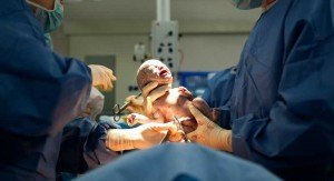 C-Section With a Side of Labor; The Recipe for Better Baby Health 1