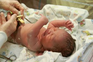 The Benefits of Delayed Cord Clamping 