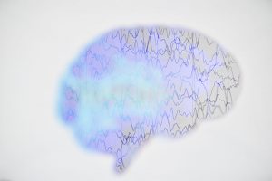 Epilepsie und Schwangerschaft: Sicherheit und Empfehlungen 