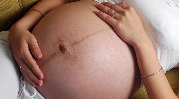 Linea nigra: Die dunkle Linie auf dem Schwangerschaftsbauch