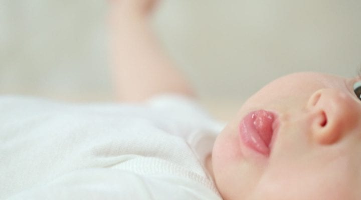 Wie ein angewachsenes Zungenbändchen beim Baby zu verstehen und zu behandeln ist 2