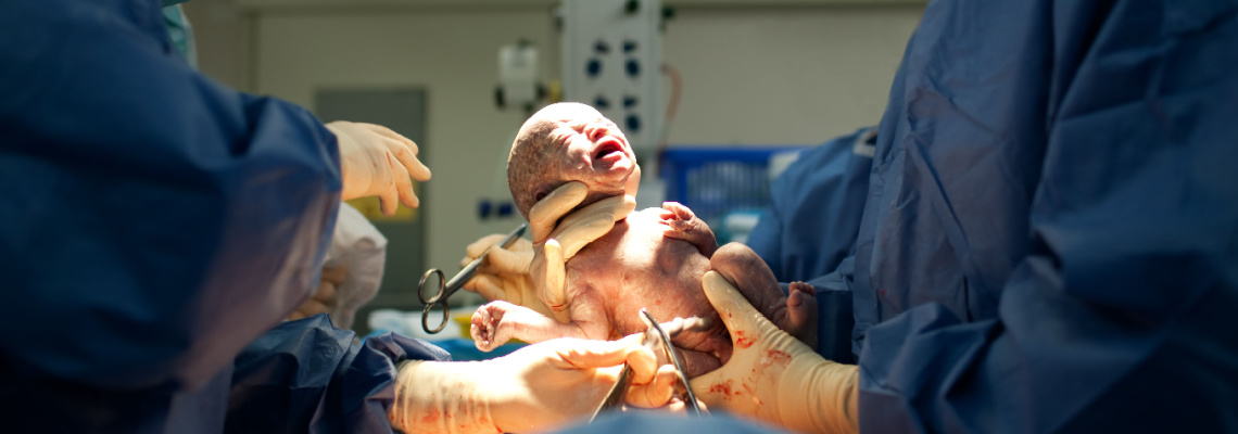 Erhalten Babys, die per Kaiserschnitt zur Welt kommen, weniger wichtige Darmbakterien?