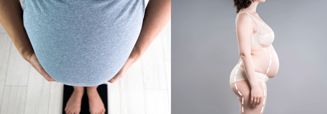 Frauen mit Adipositas müssen während der Schwangerschaft nicht an Gewicht zunehmen, wie eine neue Studie nahelegt