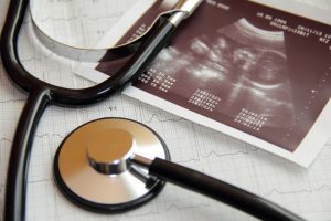 Wissenschaftler erklären endlich den wahren Grund für die morgendliche Übelkeit bei Schwangeren 1