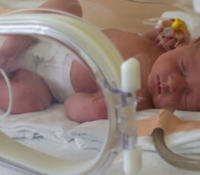 Gentherapie behebt Hauptursache für Totgeburten und Frühgeburten im Meerschweinchenmodell