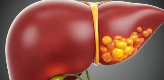 Wissenschaftler haben eine Darmverbindung entdeckt, die zum Schutz der Leber beiträgt