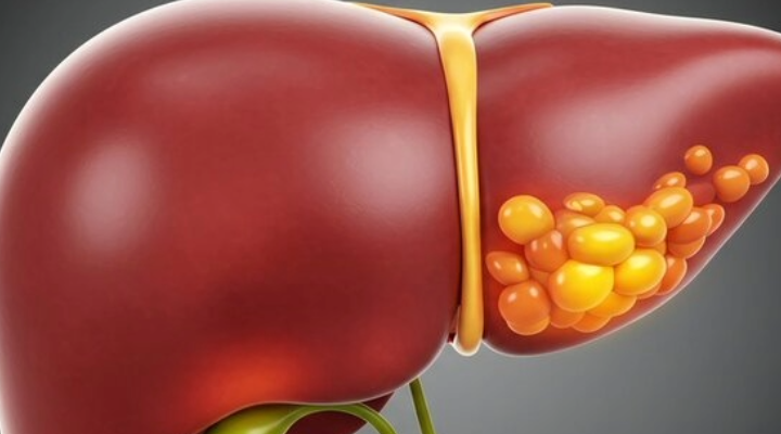 Wissenschaftler haben eine Darmverbindung entdeckt, die zum Schutz der Leber beiträgt