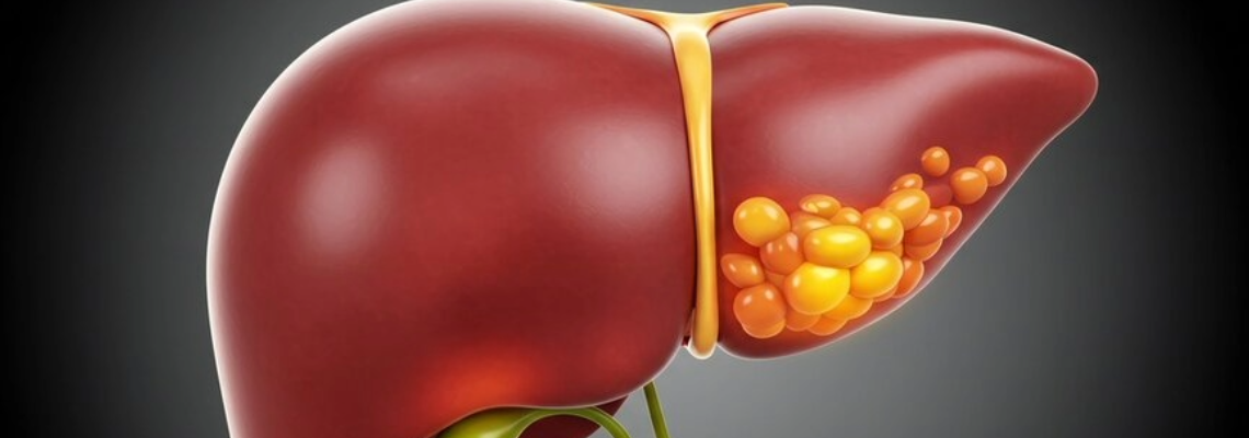 Wissenschaftler haben eine Darmverbindung entdeckt, die zum Schutz der Leber beiträgt