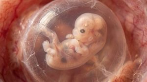 Neuer Bluttest könnte Tausende genetische Erkrankungen in der Schwangerschaft erkennen 2