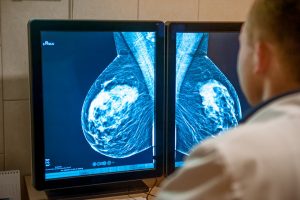 Brustkrebs nach der Geburt: Die ersten Jahre könnten ein besonderes biologisches Risiko darstellen 1