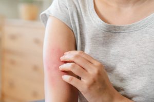 Eier und Erdnüsse in der Schwangerschaft: Kann die Ernährung Allergien beim Baby verhindern? 2
