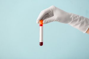 Können Blutproteine in der Schwangerschaft Hinweise auf spätere Gesundheitsrisiken geben? 18